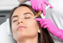 Platelet Rich Plasma Therapy